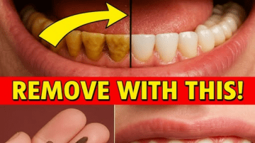 Over 60: 13 Heart Failure Warning Signs You Ignore Every Day