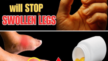 Over 60: 13 Heart Failure Warning Signs You Ignore Every Day