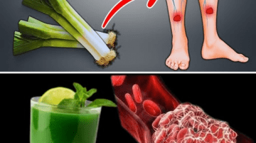 I was losing my vision and didn’t know what to do until an ophthalmologist showed me this juice