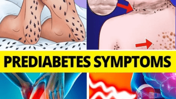 Prickly Lettuce Benefits: Uses, Safety, and Easy Recipes