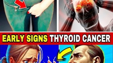 Prickly Lettuce Benefits: Uses, Safety, and Easy Recipes