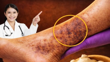 Homemade Onion Oil: A Simple Secret for Stronger Hair