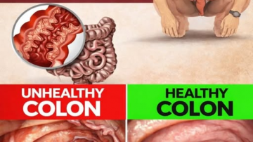 “It Looks Like I Had a Cosmetic Procedure”: The At-Home Remedy Transforming Hands and Arms