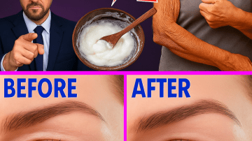 10 Hidden Skin Signs of Diabetes You Should Never Ignore