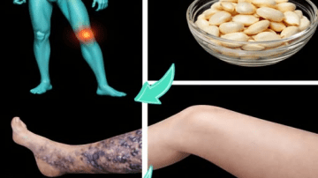 Risk! 12 WARNING Symptoms of Ovarian Cancer (Doctors Never Say) | Ovarian Cancer Symptoms