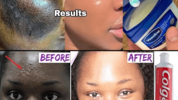 Banana Peels for Smoother Skin: Exploring Popular Recipes and Their Potential Gentle Benefits