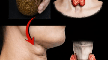 Goodbye Joint Pain: A Natural Approach to Leg Pain, Rheumatism, Varicose Veins, and Headaches