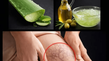 Top 3 Foods to Prevent Leg Cramps in Seniors Strengthen Your Legs! Barbara O’Neill