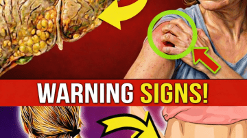 Doctors Warn: This Itchy Spot Could Be 99% Cancer. Early Warning Signs Older Adults Must Know