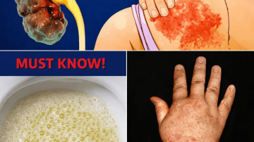 Seniors: A Spoonful Before Bed to Support Better Circulation in Your Legs and Feet!