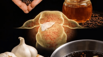 8 Critical Colon Cancer Symptoms You Should Never Ignore