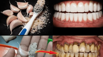 Doctors Warn: These 5 Reheated Foods May Quietly Raise Pancreatic Cancer Risk Factors – What Science Actually Shows