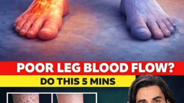 Vitamin B12 Deficiency Symptoms That Should Never Be Ignored