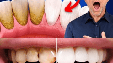 Vitamin B12 Deficiency Symptoms That Should Never Be Ignored