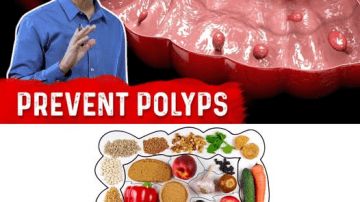 These Are the Key Vitamins Your Body Often Needs When Legs and Bones Start Aching