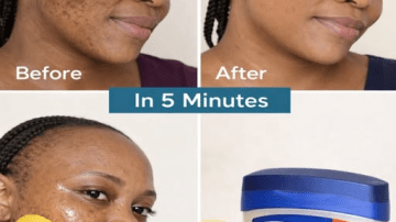 How Can Onions Naturally Support Your Eye Health at Home?