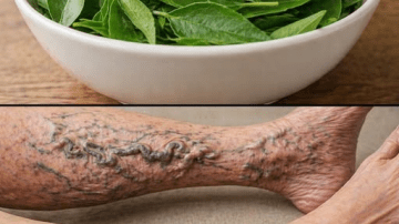 Most Women Over 45 Don’t Know This About Their Chronic Pelvic Pain