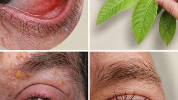 10 Surprising Foods That May Be Raising Your Cholesterol Without You Realizing It