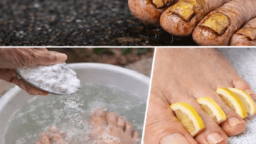 Simple Natural Tips to Keep Your Teeth Healthy – Avoid Extra Dental Visits with These 5 Natural Cavity Remedies