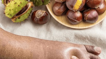 Onion and Onion Skins: A Gentle Natural Approach to Prostate and Bladder Wellness